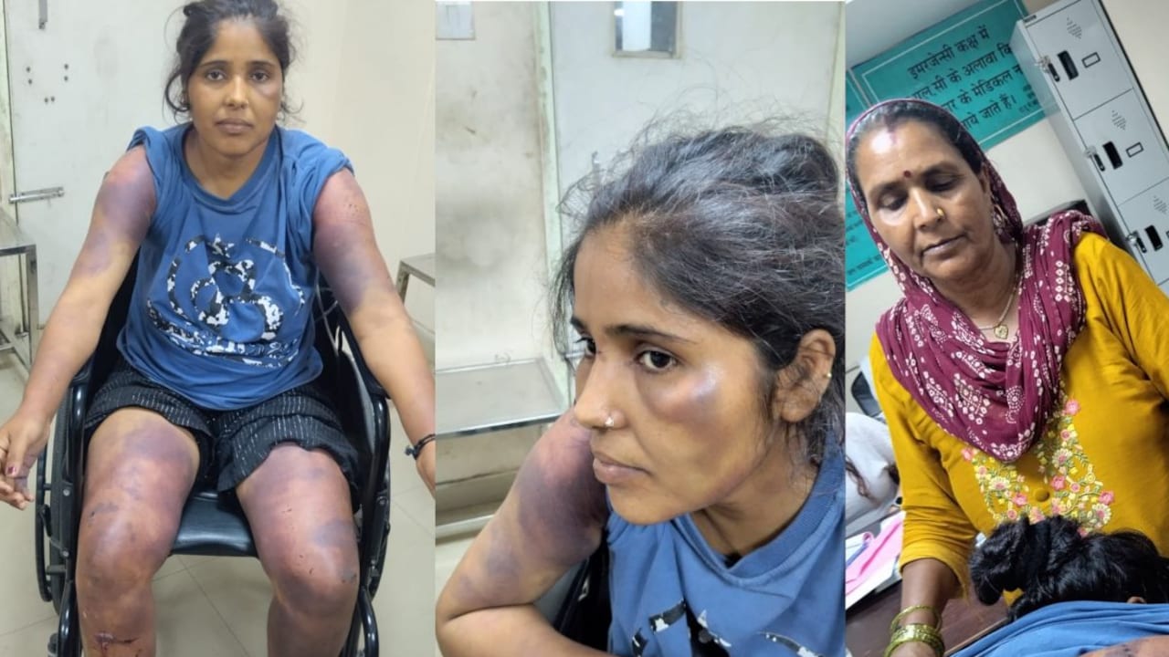 पत्नी को था इंस्टाग्राम का शौक, गुस्साए पति ने 8 माह की गर्भवती को बेरहमी से पीटा, गर्भ में ही मासूम की मौत