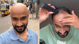 Kerala Man Shares Why He Shaved Off His Head: "Wasn't Just A Haircut"