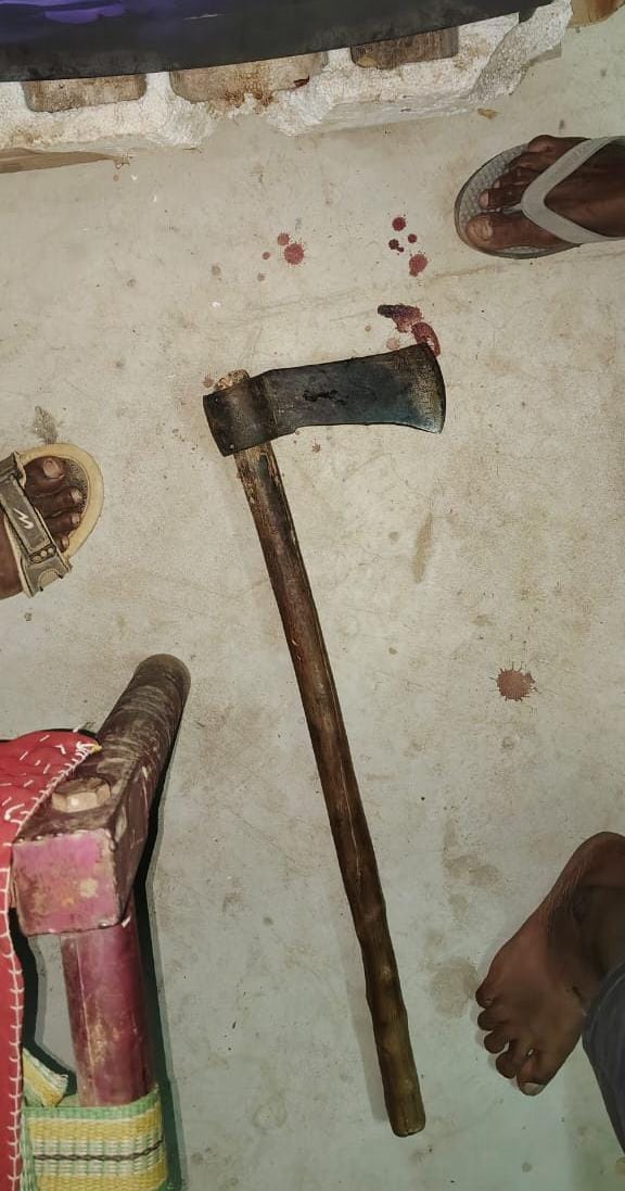 Wife Murder Case Chhattisgarh: हत्या में प्रयुक्त हथियार