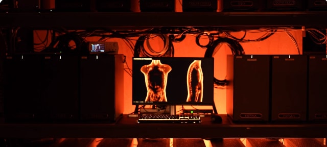 MRI Killer? Midjourney Claims Its Full-Body Scan Does The Job In 60 Seconds
