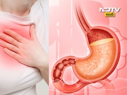 What Is Acidity: पोटात जळजळ होते? अ&zwj;ॅसिडिटी म्हणजे काय? तुमच्या या 7 वाईट सवयी तातडीने बंद करा, अन्यथा...