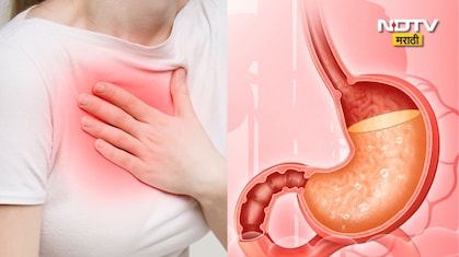 What Is Acidity: पोटात जळजळ होते? अ‍ॅसिडिटी म्हणजे काय? तुमच्या या 7 वाईट सवयी तातडीने बंद करा, अन्यथा...
