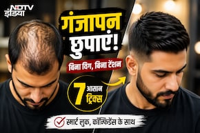 गंजापन छुपाना है? बिना विग अपनाएं ये 5 ट्रिक्स, मिनटों में बदल जाएगा लुक