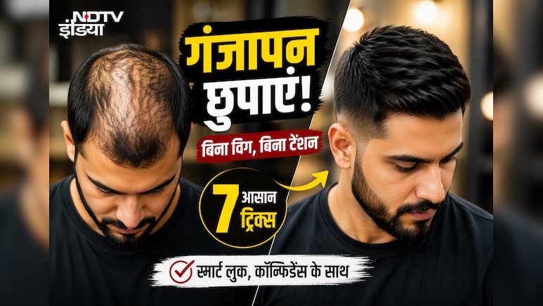 गंजापन छुपाना है? बिना विग अपनाएं ये 5 ट्रिक्स, मिनटों में बदल जाएगा लुक