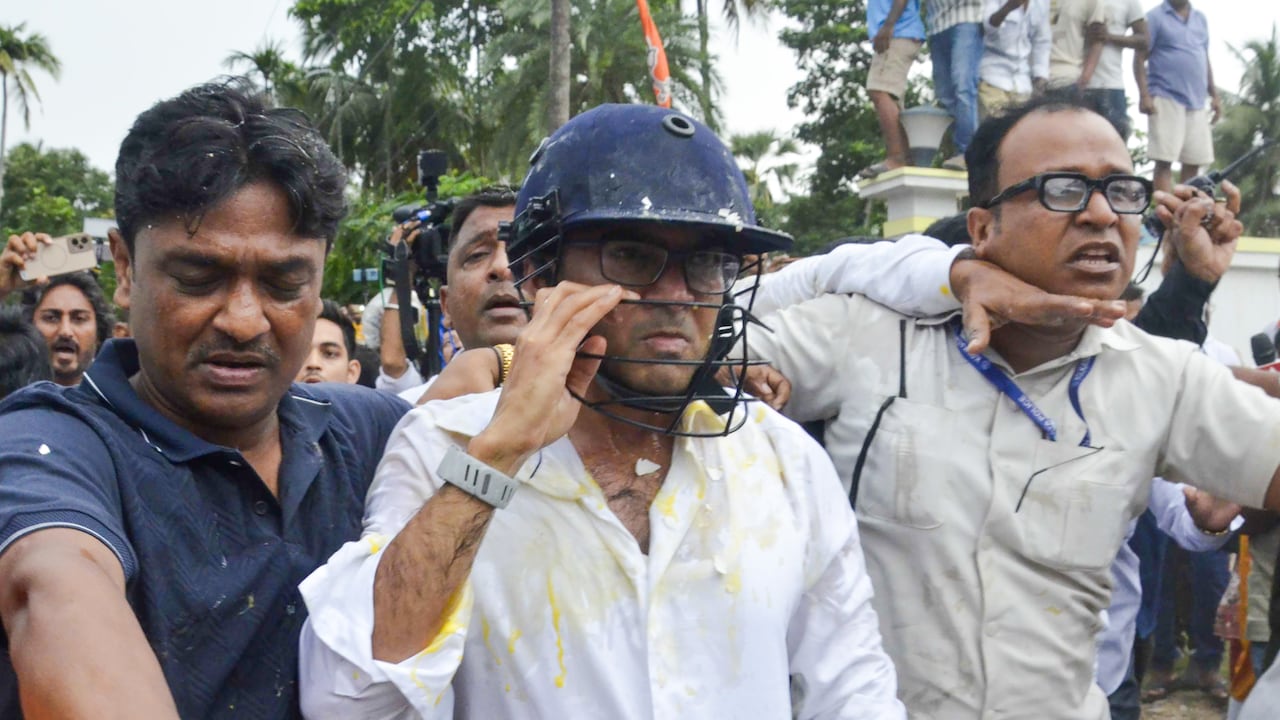 Abhishek Banerjee Anda Attack Abhishek Banerjee Anda Attack
