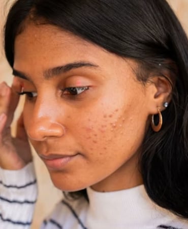 7 Foods That Affect Your Skin Health