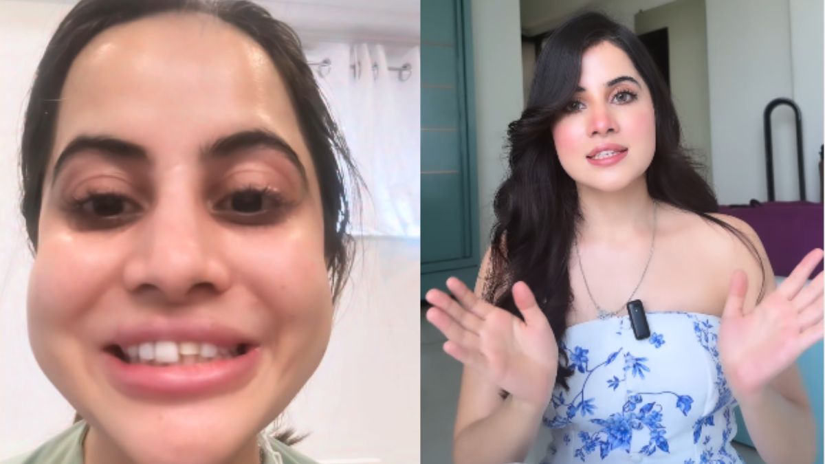Uorfi Javed Reveals What Triggered Facial Swelling Last Year: "<i>Koi Filler Nahi Tha</i>"