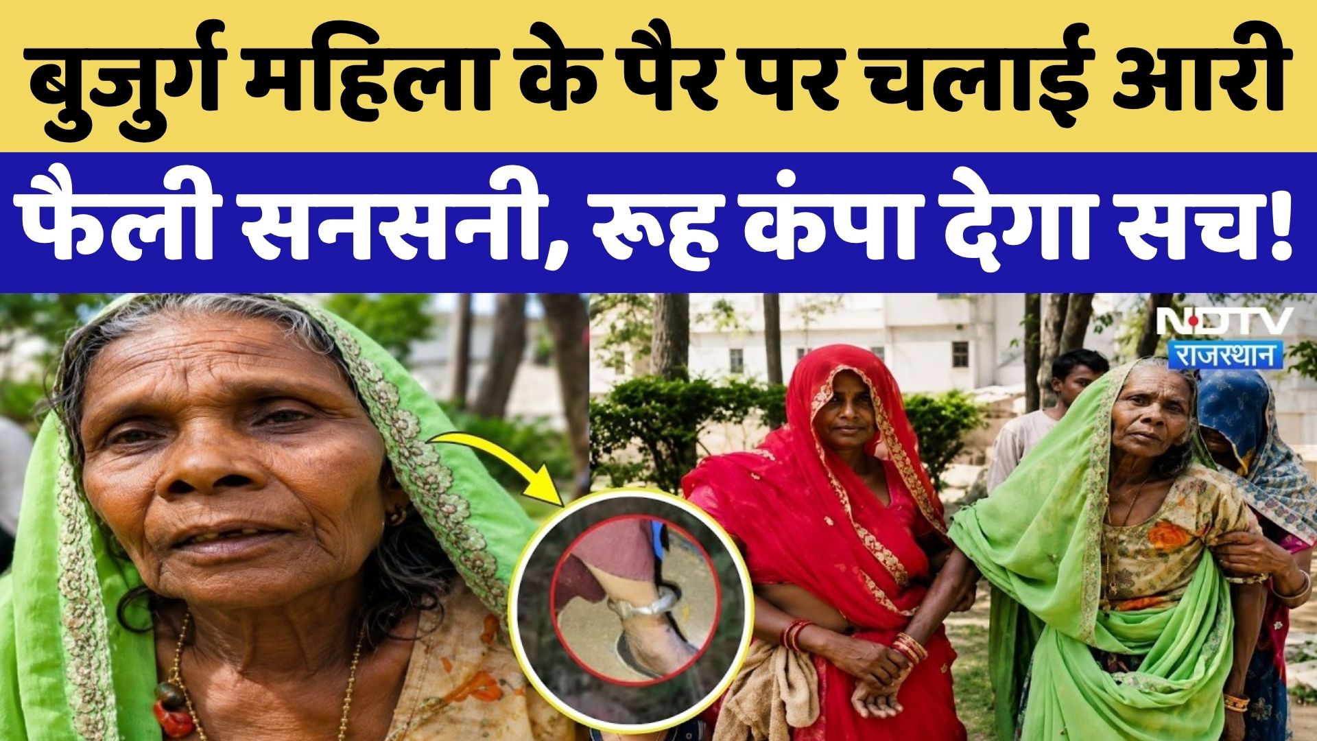 Silver के कड़े के लिए बदमाशों ने महिला के पैर पर चलाई आरी, अधमरा कर छोड़ा! Udaipur News |Viral Video