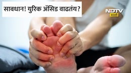 Uric Acid Control Tips: 'मी फक्त डाळ खातो,तरीही युरिक अ&zwj;ॅसिड का वाढतंय?' जाणून घ्या काय खावे आणि काय टाळावे