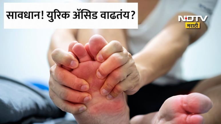 Uric Acid Control Tips: 'मी फक्त डाळ खातो,तरीही युरिक अ&zwj;ॅसिड का वाढतंय?' जाणून घ्या काय खावे आणि काय टाळावे