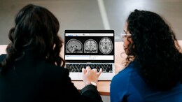 Doctors Suspected Brain Cancer In Spanish Man With Chronic Headaches. Scans Revealed Otherwise