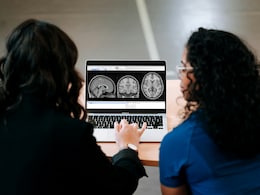 Doctors Suspected Brain Cancer In Spanish Man With Chronic Headaches. Scans Revealed Otherwise