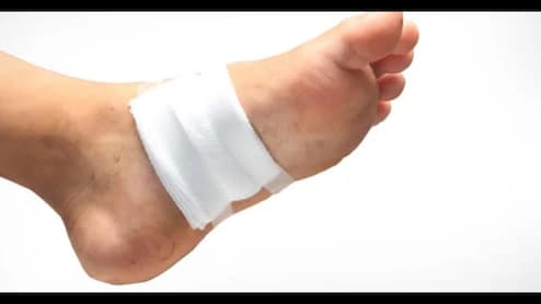 डायबिटीज मरीजों के लिए राहत! देशभर में खुलेंगे Wound Care Center, अब एक ही जगह मिलेगा पूरा इलाज