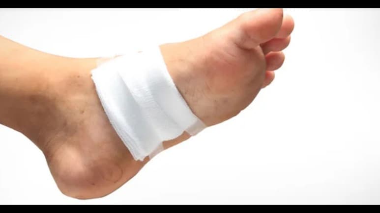 डायबिटीज मरीजों के लिए राहत! देशभर में खुलेंगे Wound Care Center, अब एक ही जगह मिलेगा पूरा इलाज
