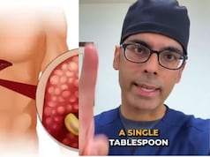 फैटी लिवर में क्या खाएं? AIIMS ट्रेंड डॉक्टर ने बताए 5 हेल्दी स्नैक्स