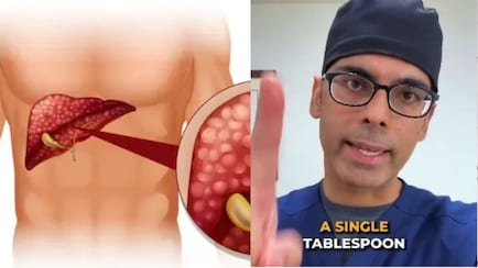फैटी लिवर में क्या खाएं? AIIMS ट्रेंड डॉक्टर ने बताए 5 हेल्दी स्नैक्स