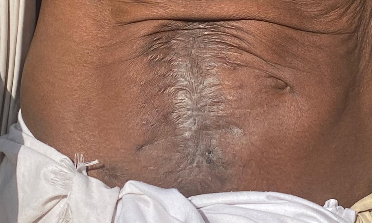 Tapeshwar Yadav,Chtan Das