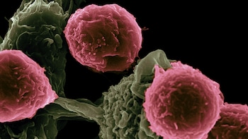 Oncologists Give Standing Ovation For Breakthrough Pancreatic Drug | Watch Video