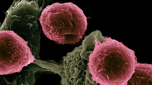 Oncologists Give Standing Ovation For Breakthrough Pancreatic Drug | Watch Video
