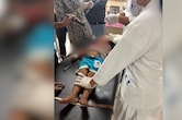 3 साल के बच्चे के चेहरे पर आए 55 टांके, उज्जैन में मासूम को आवारा कुत्ते ने बुरी तरह नोचा