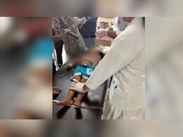 3 साल के बच्चे के चेहरे पर आए 55 टांके, उज्जैन में मासूम को आवारा कुत्ते ने बुरी तरह नोचा