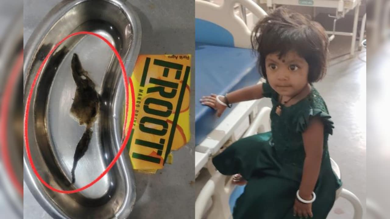 पैकेट वाले मैंगो जूस में निकला सांप जैसा जंतु! पीने के बाद तीन साल की हुई बीमार