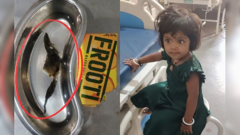 पैकेट वाले मैंगो जूस में निकला सांप जैसा जंतु! पीने के बाद तीन साल की बच्ची हुई बीमार