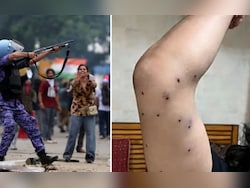 Supreme Court To Examine Protocol On Use Of Pellet Guns For Crowd Control