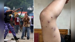 Supreme Court To Examine Protocol On Use Of Pellet Guns For Crowd Control