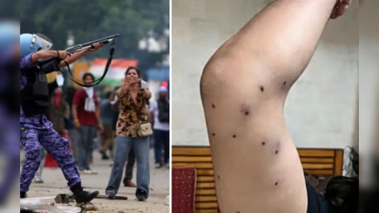Supreme Court To Examine Protocol On Use Of Pellet Guns For Crowd Control