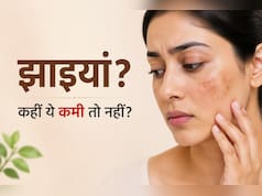 किस विटामिन की कमी की वजह से चेहरे पर झाइयां होती हैं?