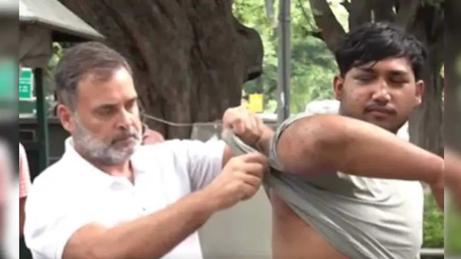 "Stop Lying": Pellet Victim By His Side, Rahul Gandhi Targets Centre
