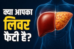 AIIMS डॉक्टर ने बताए फैटी लिवर से जुड़े 3 म&zwj;िथ्&zwj;स