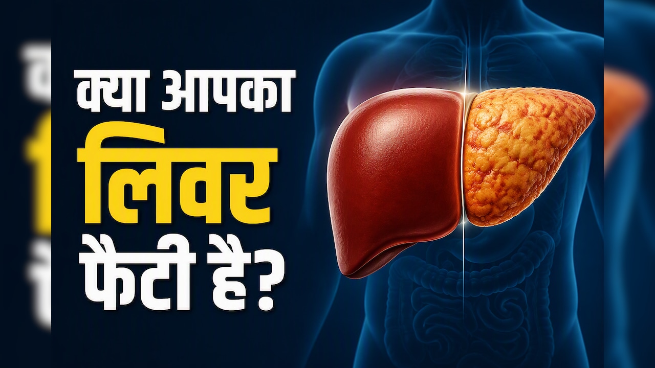 AIIMS डॉक्टर ने बताए फैटी लिवर से जुड़े 3 म‍िथ्‍स