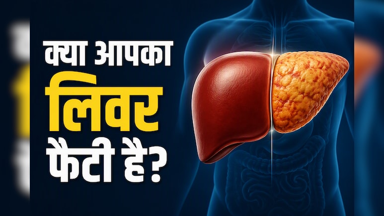 AIIMS डॉक्टर ने बताए फैटी लिवर से जुड़े 3 म&zwj;िथ्&zwj;स