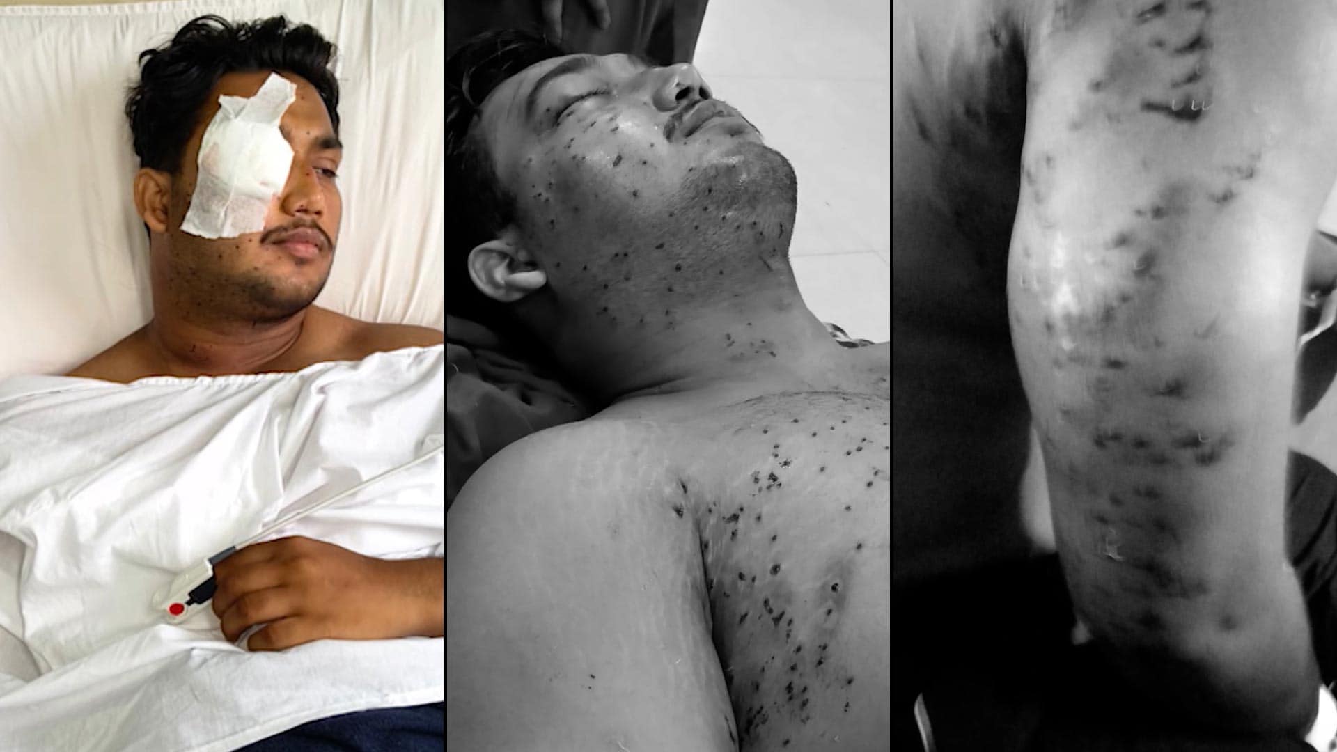 CRPF Probes Pellet Gun Use During July 20 Protest; RAF Personnel Identified