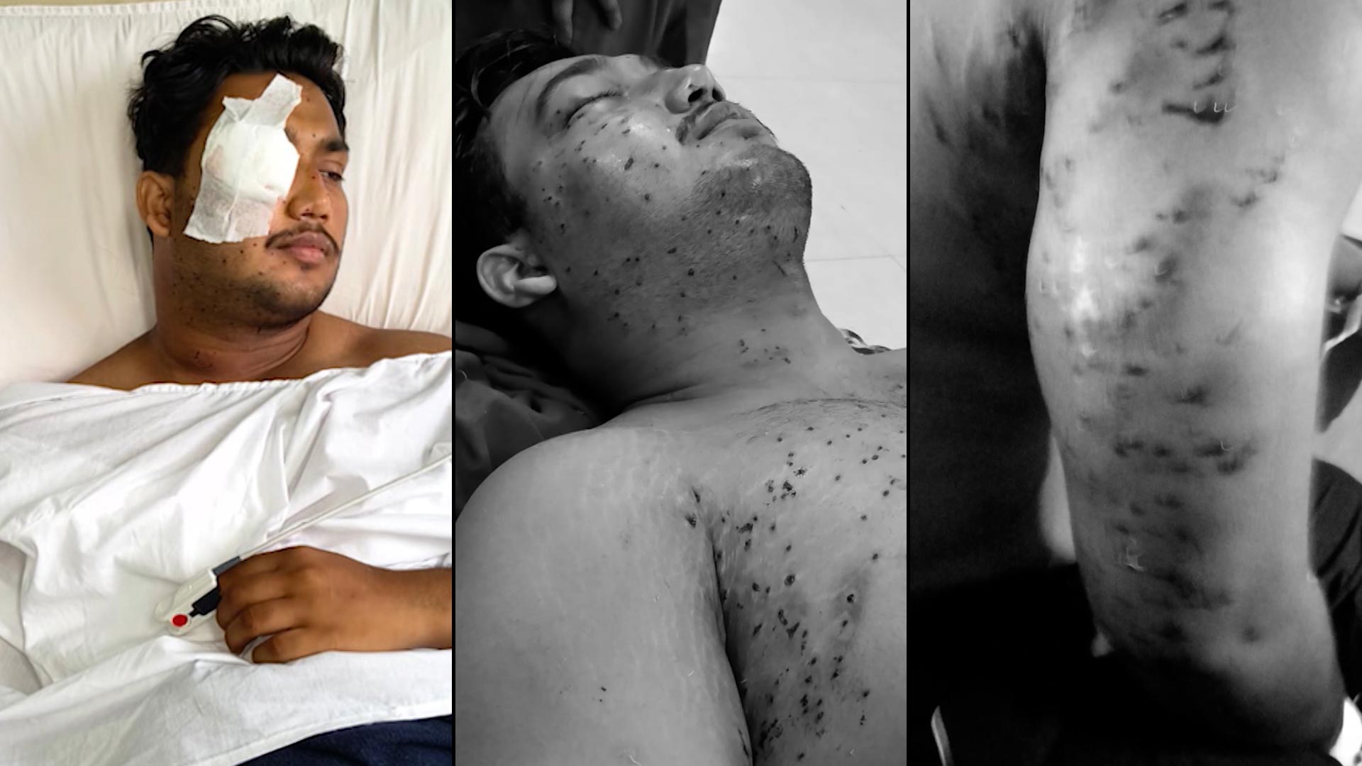 CRPF Probes Pellet Gun Use During July 20 Protest; RAF Personnel Identified