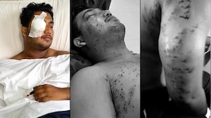 CRPF Probes Pellet Gun Use During July 20 Protest; RAF Personnel Identified