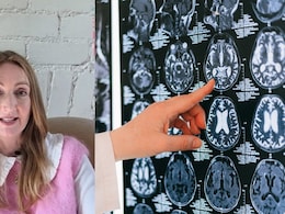 38 Parasites Found In UK Woman's Brain After Her Trip To India: What Is Neurocysticercosis?