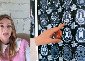 38 Parasites Found In UK Woman's Brain After Her Trip To India