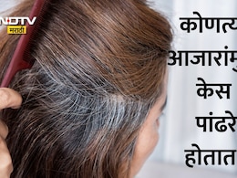 Grey Hair Causes: सावधान! कमी वयातच केस पांढरे होत आहेत? तुम्हाला आहेत 'हे' गंभीर आजार? जाणून घ्या 5 कारणं