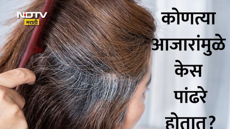 Grey Hair Causes: सावधान! कमी वयातच केस पांढरे होत आहेत? तुम्हाला आहेत 'हे' गंभीर आजार? जाणून घ्या 5 कारणं