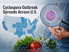 Cyclospora Parasite Outbreak: Affected Regions, Symptoms, Treatment And Precautions | Explained