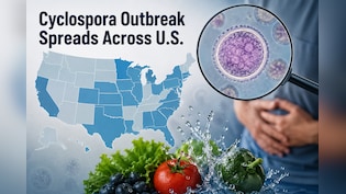 Cyclospora Parasite Outbreak: Affected Regions, Symptoms, Treatment And Precautions | Explained