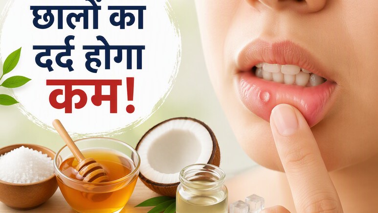 मुंह के छालों से हैं परेशान? नमक, शहद और नारियल तेल जैसे ये 5 घरेलू उपाय दिला सकते हैं राहत