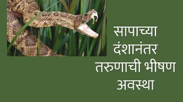 Snakebite News : सापाने तरुणाला अशा ठिकाणी केला दंश; रुग्णालयाचं बिल आलं 11 कोटी; 54 इंजेक्शनं दिलं तरीही...