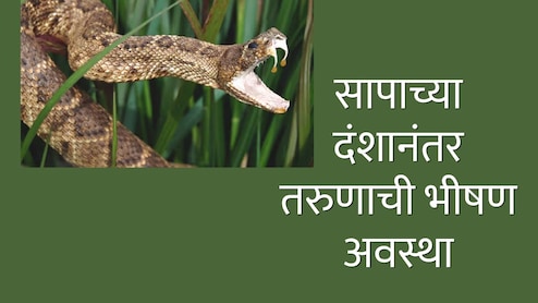Snakebite News : सापाने तरुणाला अशा ठिकाणी केला दंश; रुग्णालयाचं बिल आलं 11 कोटी; 54 इंजेक्शनं दिलं तरीही...