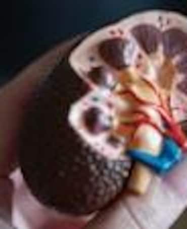 Best Fruits For Kidney Stone Patients