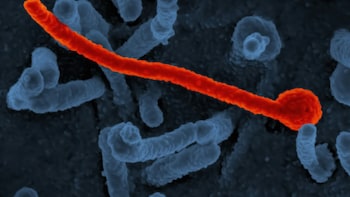 Ebola Cases Top 2,000 In Congo As Outbreak Spreads In Haut-Uele
