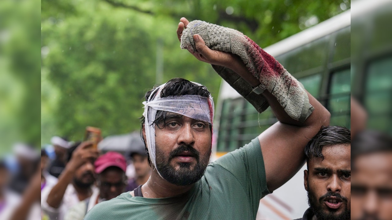 जंतर-मंतर पर प्रदर्शन के दौरान हुई पुलिस कार्रवाई में घायल शख्स जंतर-मंतर पर प्रदर्शन के दौरान हुई पुलिस कार्रवाई में घायल शख्स